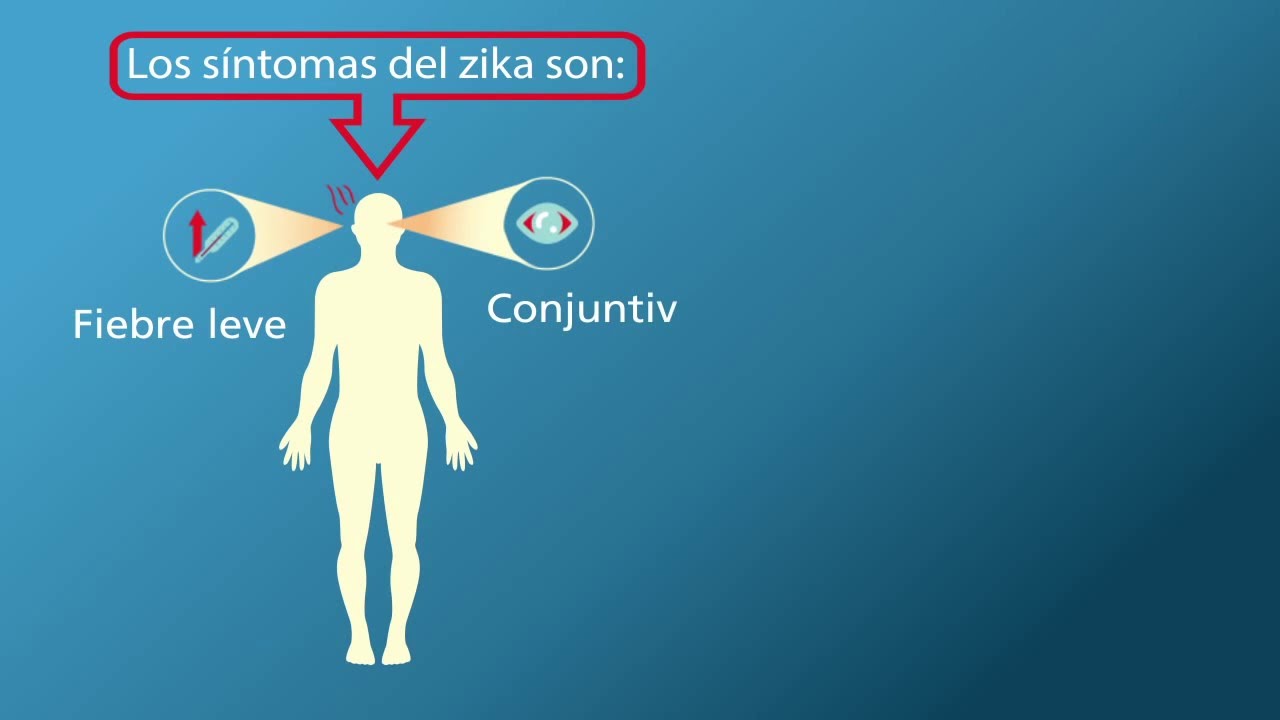 Infografía Animada Sobre La Enfermedad Del Virus Zika Campus